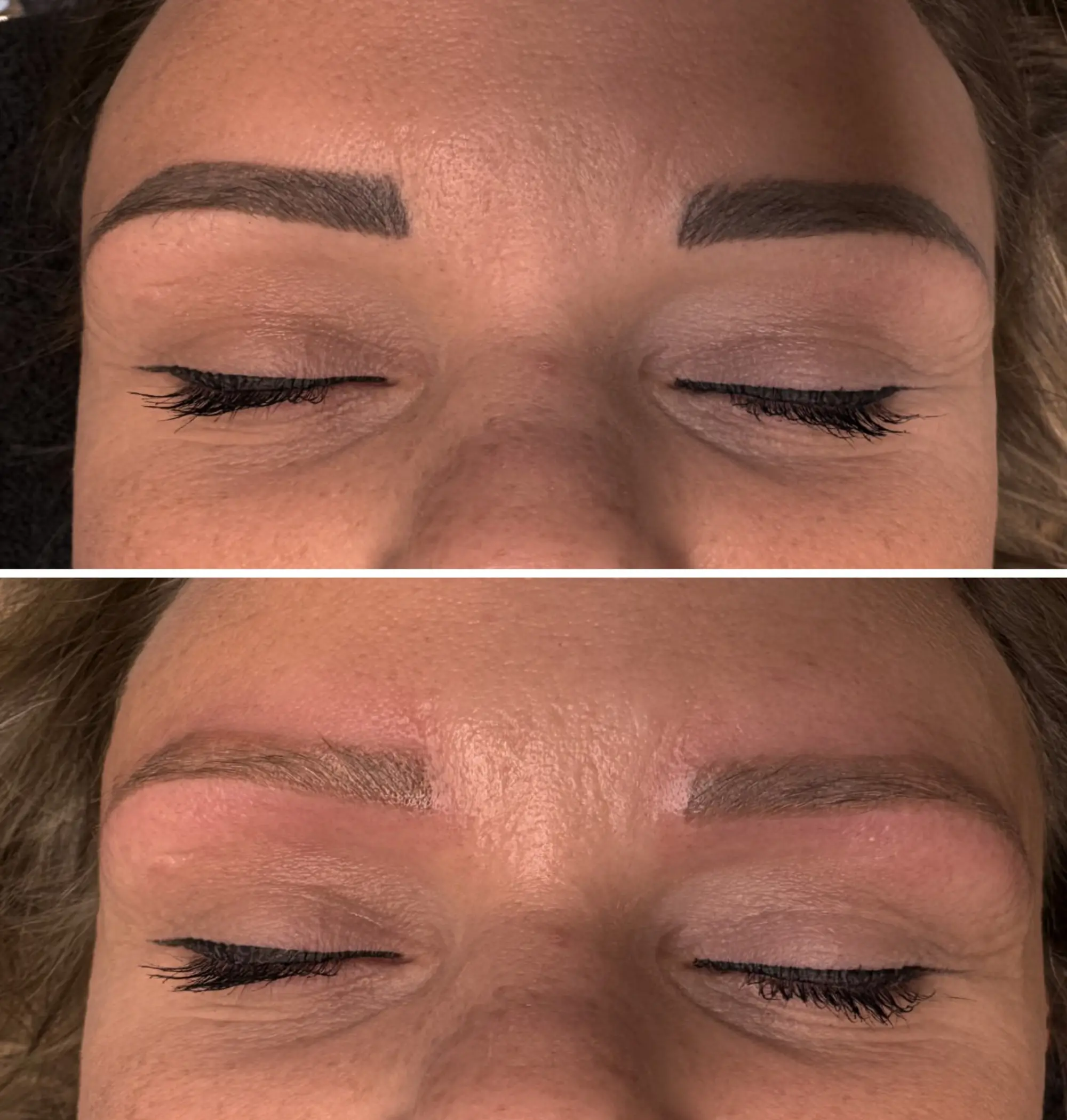 What Are The Best Aftercare Protocols Taught In The 2026 Course To Prevent Hyperpigmentation?