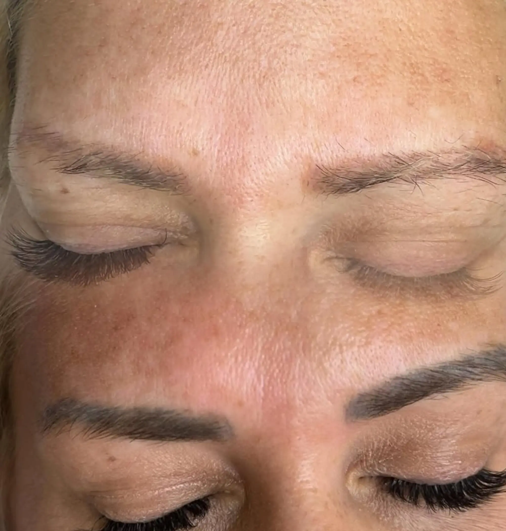 correct moisturising balance for recovering skin