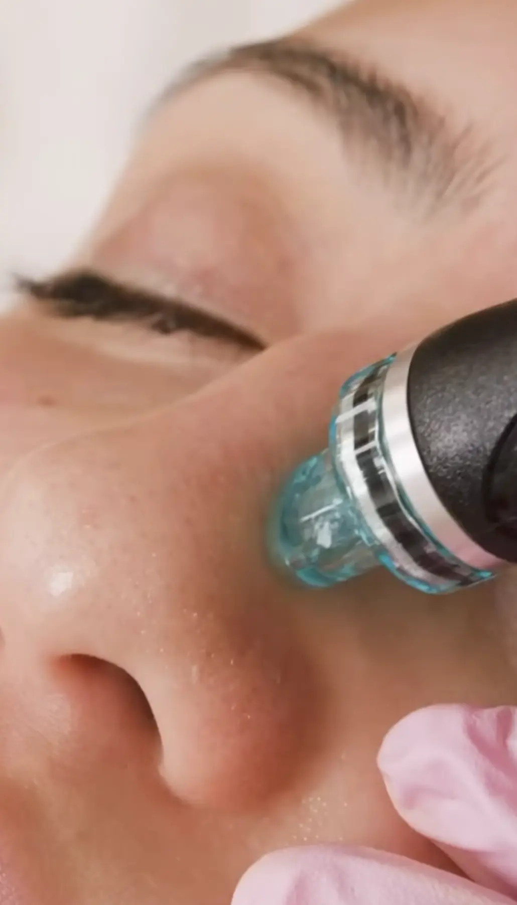 hydrafacial contraindications explained