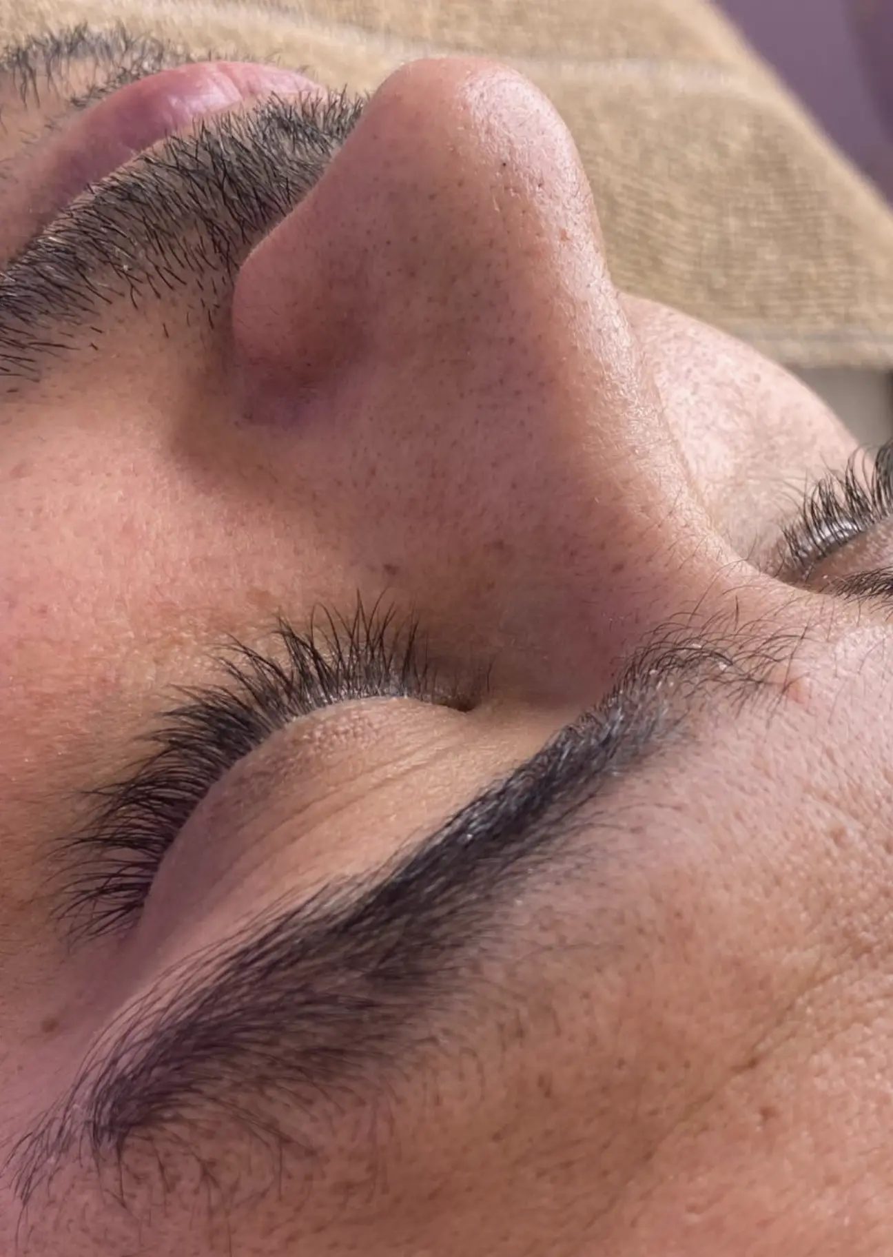 hydrafacial safety who should avoid treatment