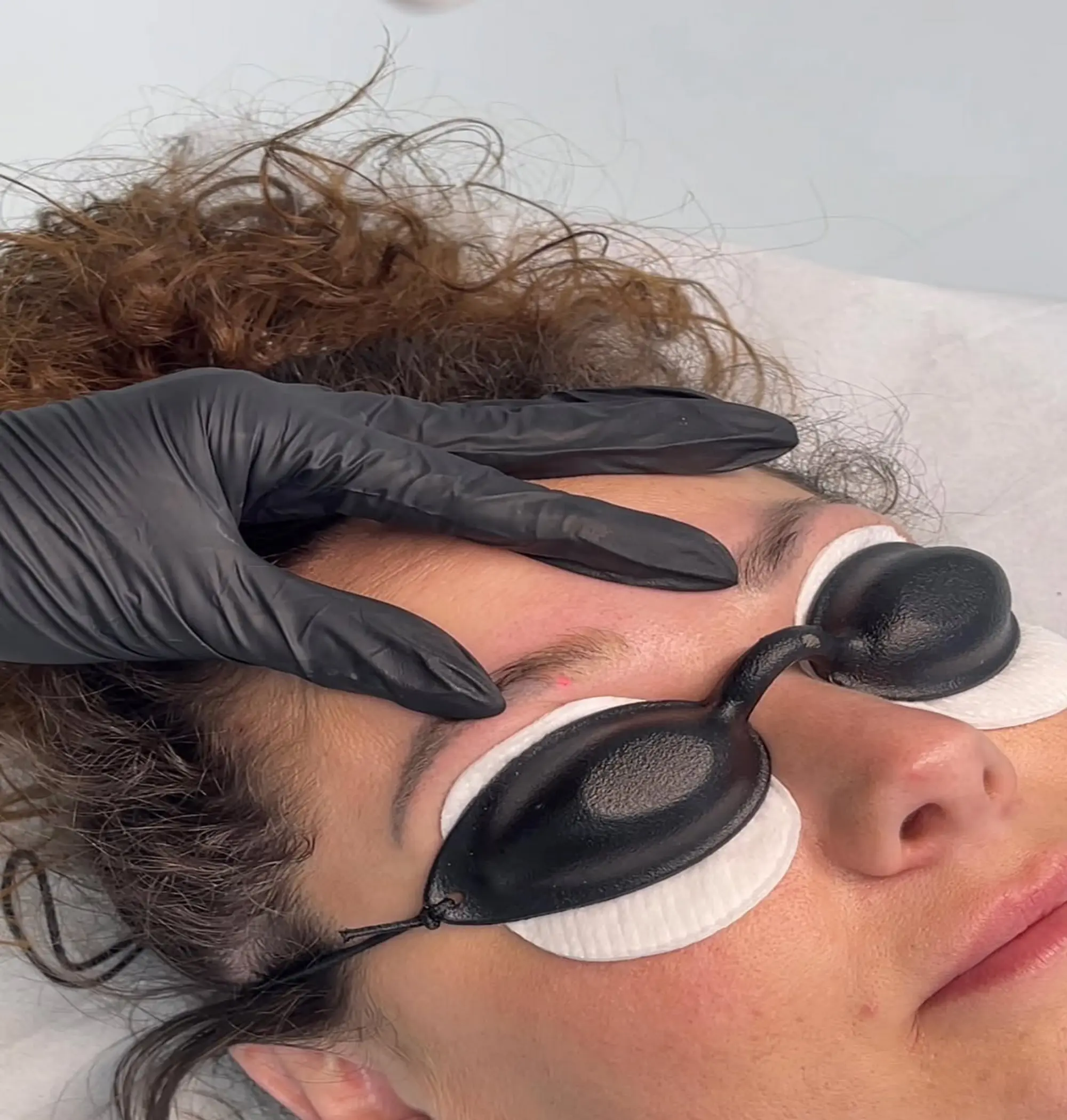 laser removal aftercare techniques