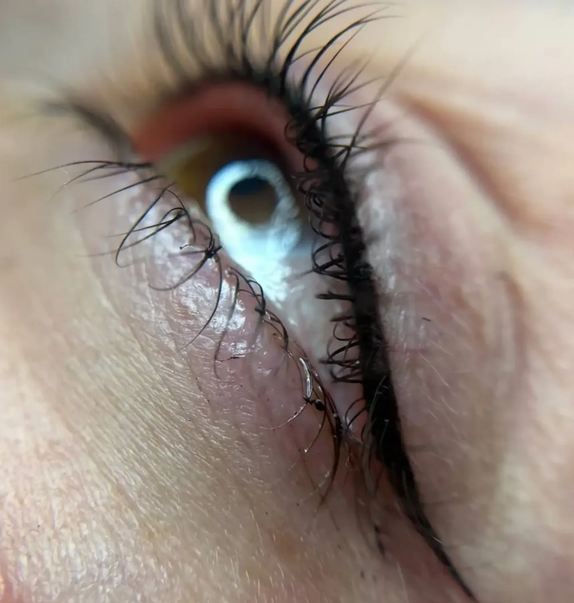 pigment spreading along lash line
