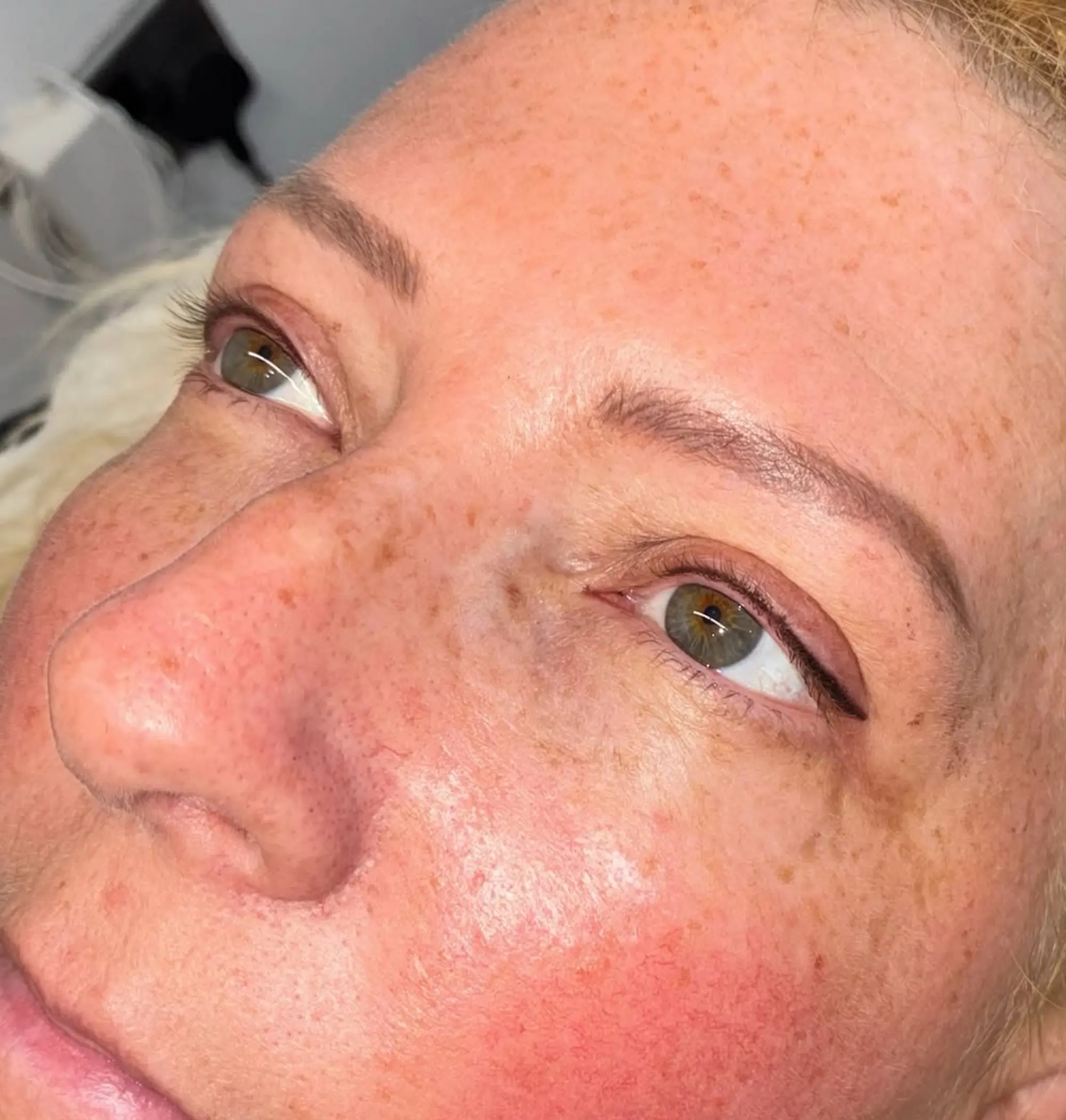 puffy eyes after eyeliner tattoo